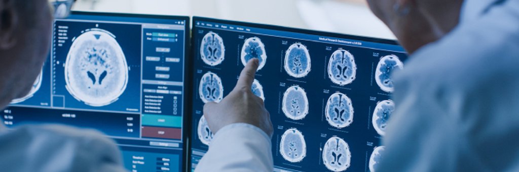 brain injury lawyer